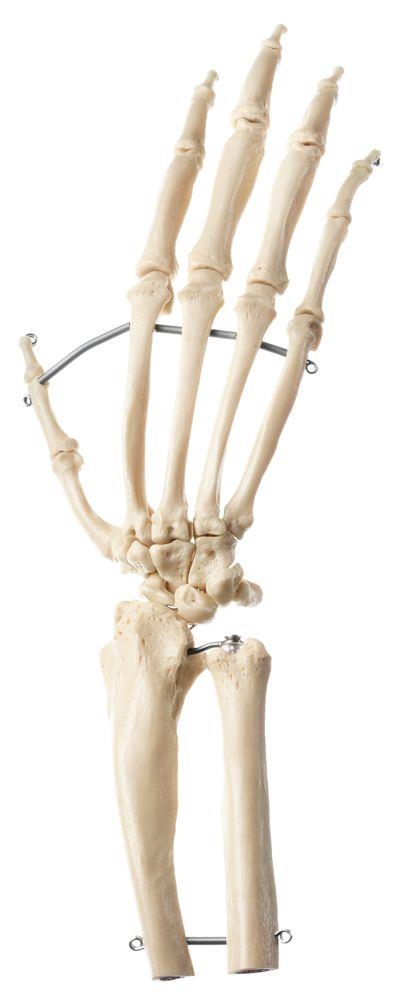 Künstliches Schimpansen-Hand-Skelett - Somso